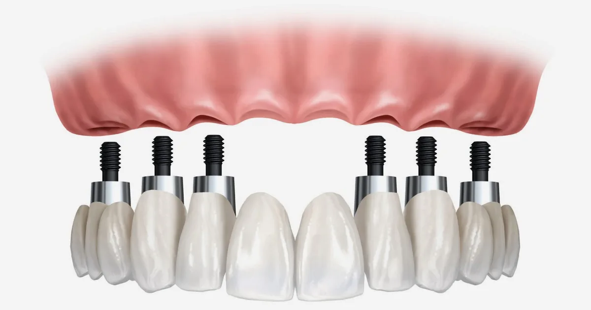 Dental MAAC