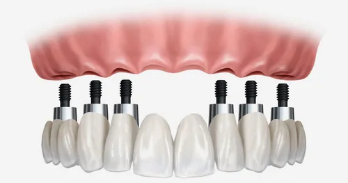 Dental MAAC, consultorio dental en Ensenada, Baja California