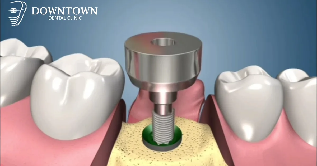 Downtown Dental Clinic