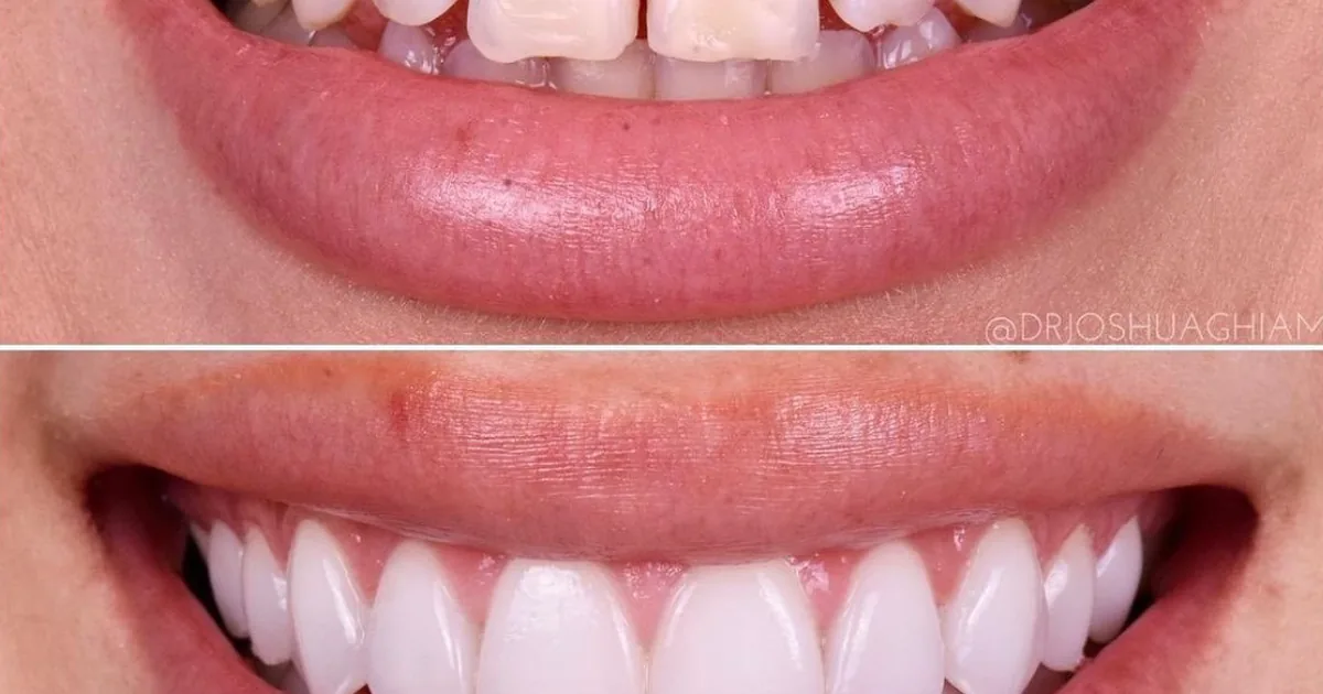 Tijuana Clinic for Cosmetic Dentistry