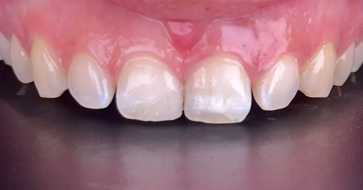 Beauty DENTAL Health Rosarito
