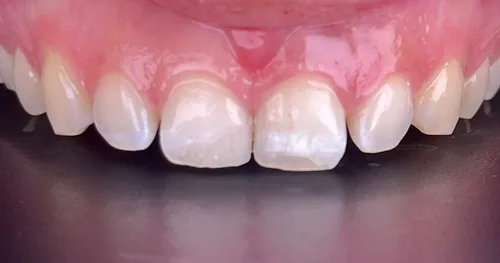 Beauty DENTAL Health Rosarito, consultorio dental en Playas de Rosarito, Baja California