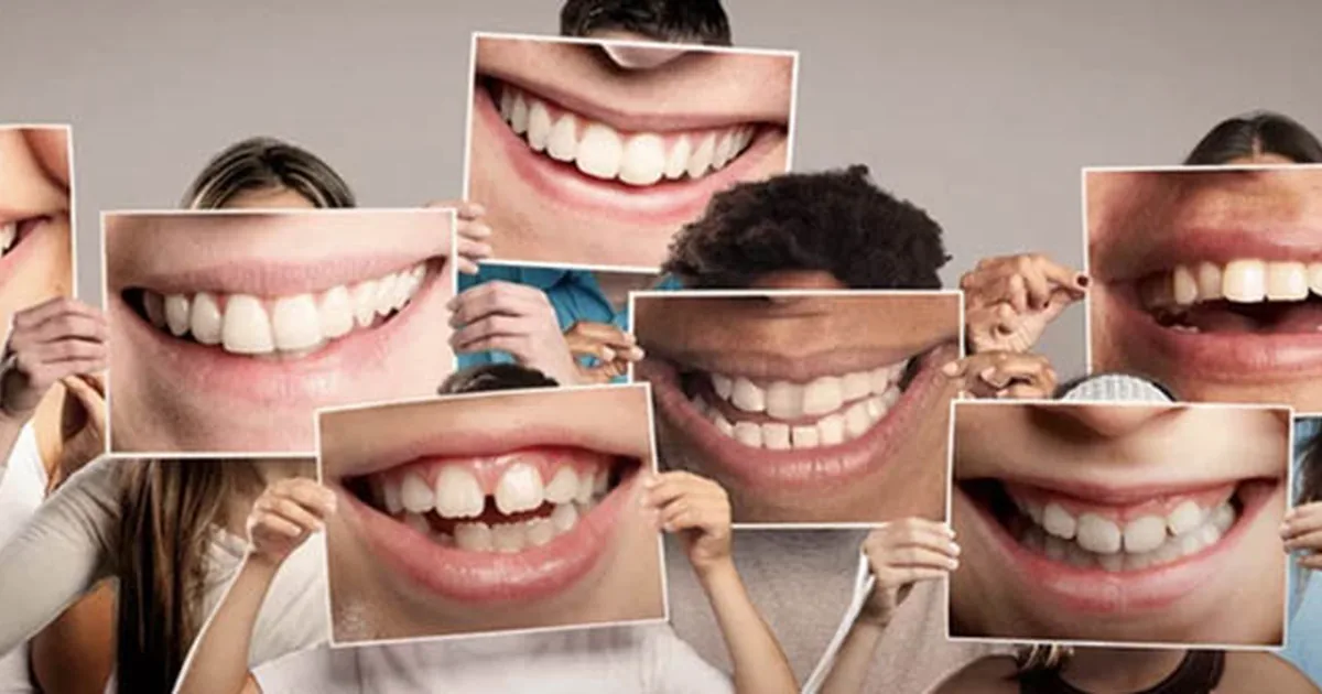 Llanas Dental ® | Dentista en Cd Juárez