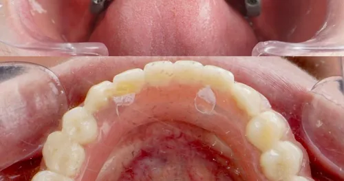 Odent clínica dental, consultorio dental en Piedras Negras, Coahuila