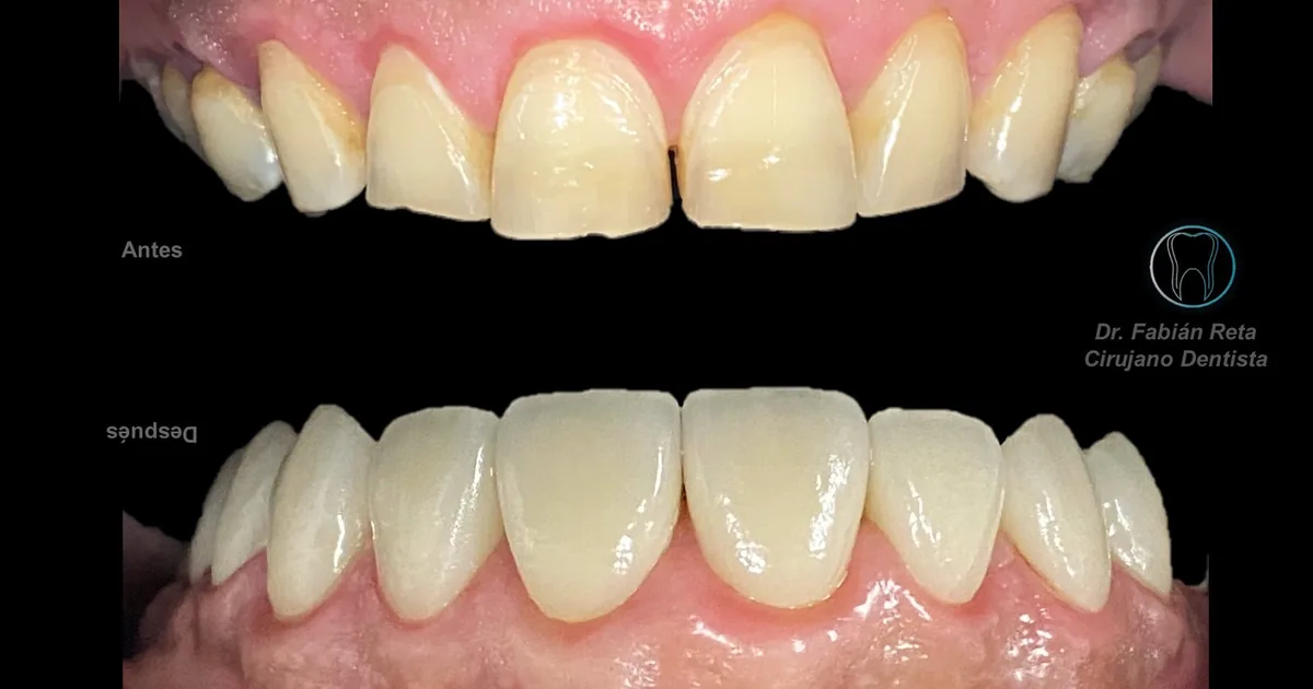 Dr. Fabián Reta – Clínica Dental