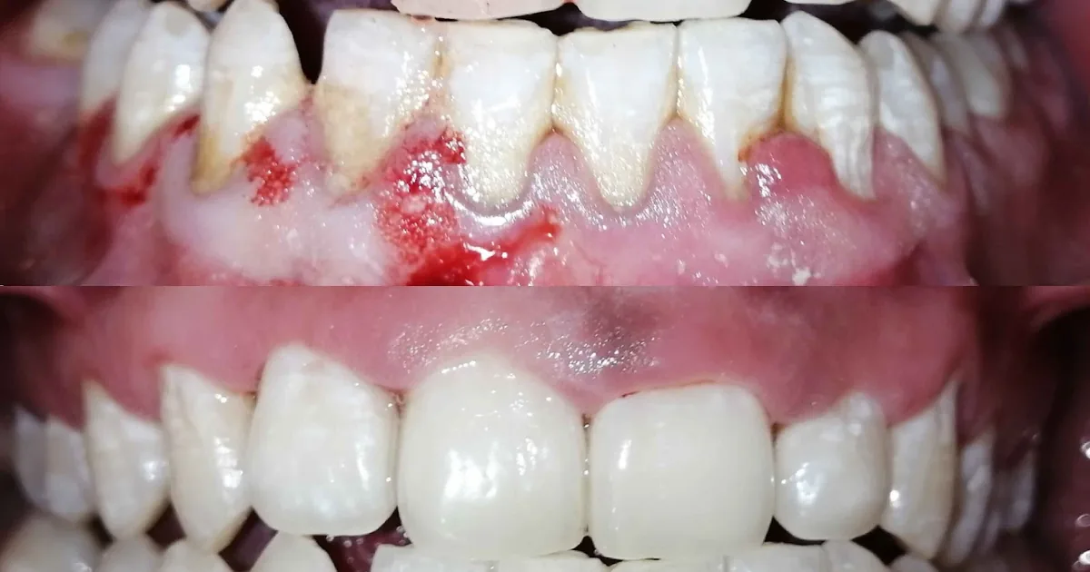 LA DENTISTA