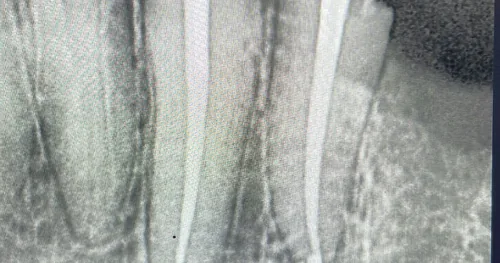 Dentista en Culiacán LabsEndo Endodoncia Dolor Dental e Implantes Dentales Dr kevin DDS, consultorio dental en Culiacán, Sinaloa