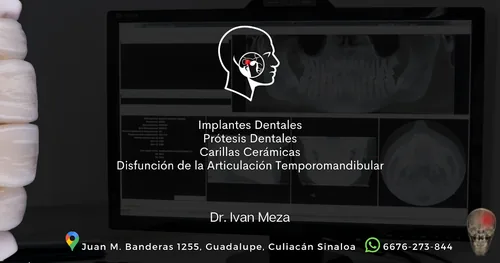 Implantes Dentales / Carillas Dentales / Dr. Ivan Meza, consultorio dental en Culiacán, Sinaloa