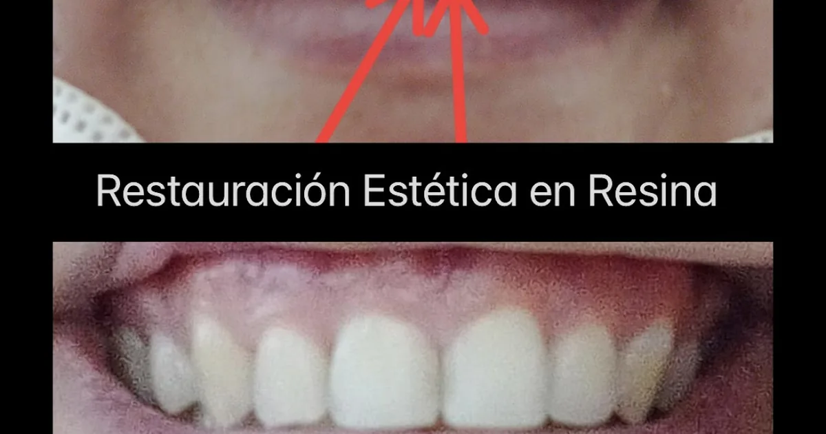 Consultorio Dental Jennifer Hernandez Dentista
