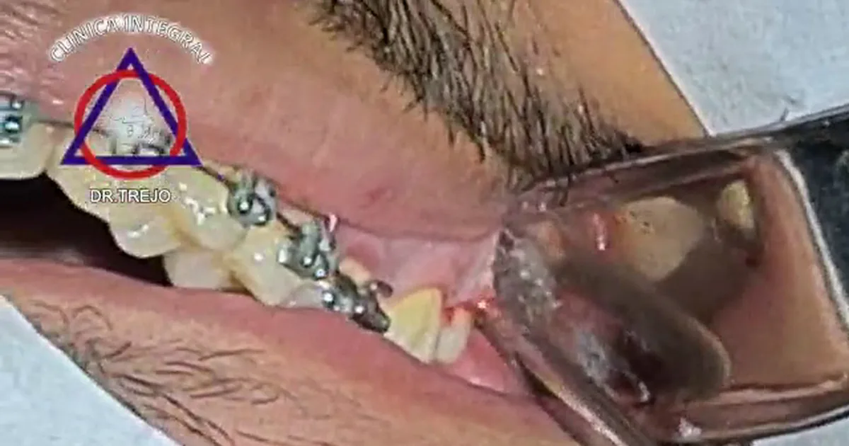 Clínica Integral Dr Trejo. Cirugía Maxilofacial Y Odontología.