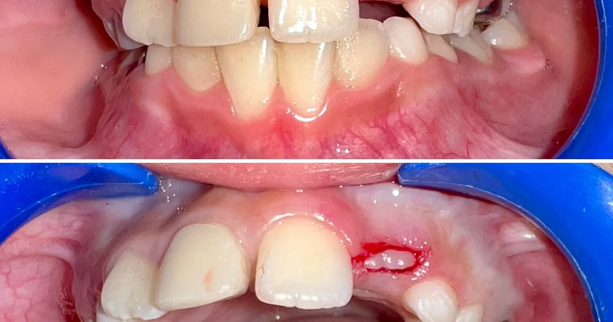 Dental Mouth