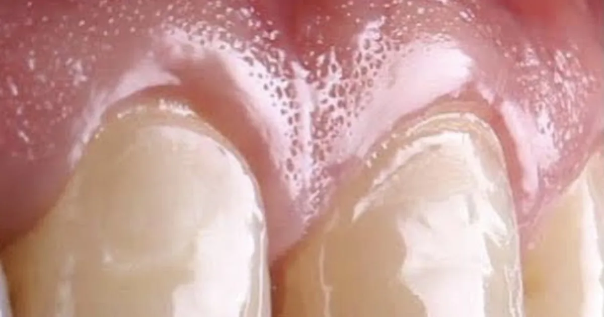 Dr. Héctor Miguel Padilla Millán periodoncia e Implantología