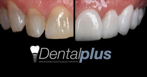 Dentalplus, consultorio dental en San Luis Potosí, San Luis Potosí