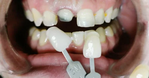 Dr Oliver Aguirre, consultorio dental en Hermosillo, Sonora