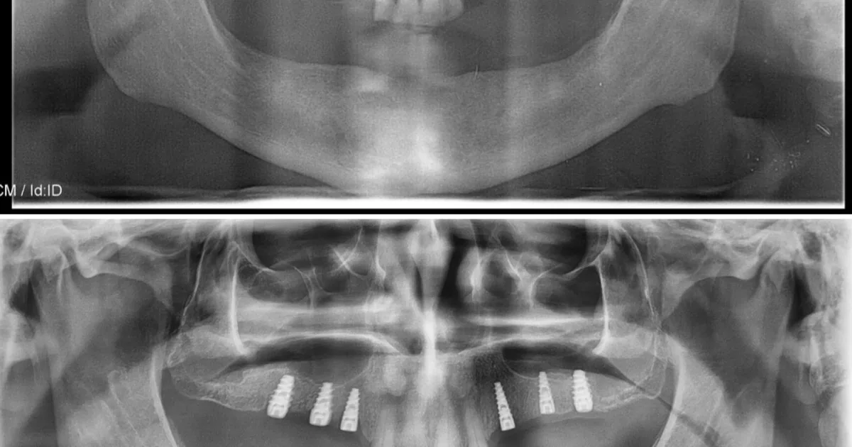 Dr.Leopoldo Vega – Dentista Ciudad Victoria