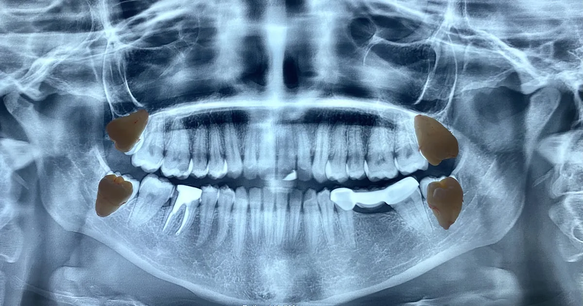 Cirujano Maxilofacial Dr. Roberto Garza