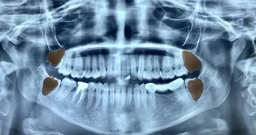 Cirujano Maxilofacial Dr. Roberto Garza, consultorio dental en Ciudad Victoria, Tamaulipas