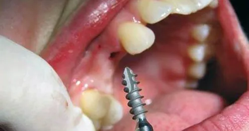 Clínica Dental Funnydent, consultorio dental en Matamoros, Tamaulipas