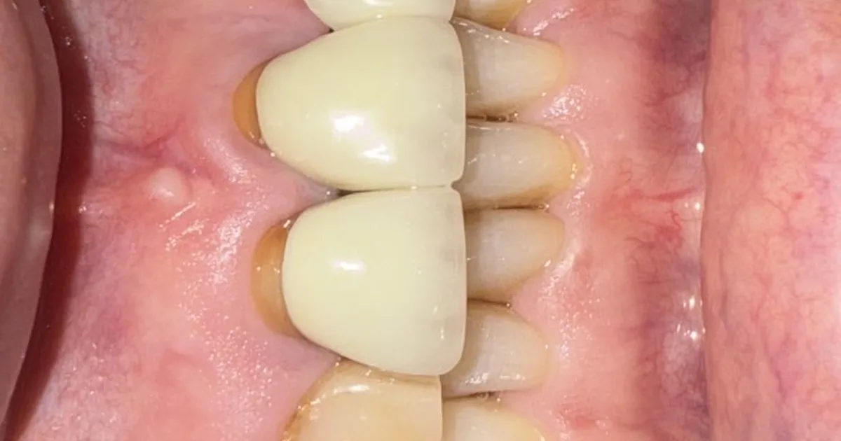 Dentista Matamoros CONDENT