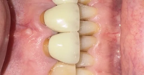 Dentista Matamoros CONDENT, consultorio dental en Matamoros, Tamaulipas