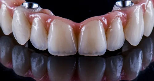 Dr Héctor Garza, consultorio dental en Nuevo Laredo, Tamaulipas