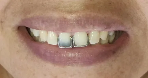 Dra. Laura M. Moya, consultorio dental en Nuevo Laredo, Tamaulipas