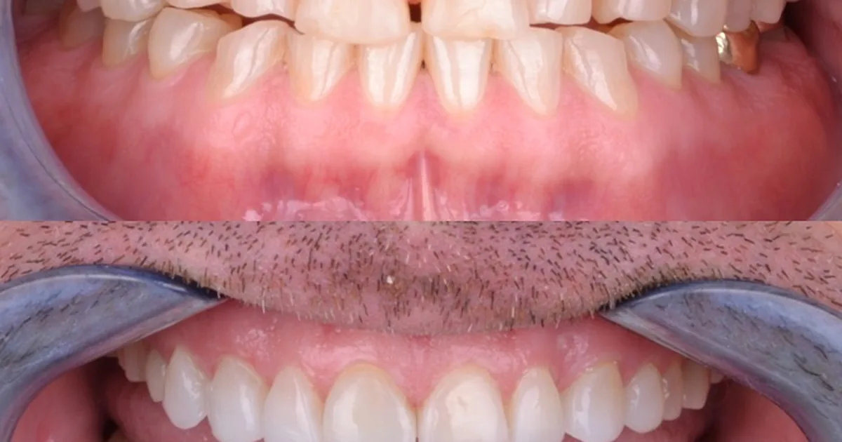 Dr.Jessiel Medina Advance Dental Care