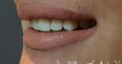SPA DENTAL REYNOSA, consultorio dental en Reynosa, Tamaulipas