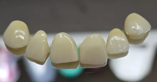 MOLAR CONSULTORIO DENTAL 24HRS AGS, consultorio dental en Aguascalientes, Aguascalientes