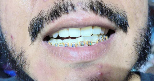 Consultorio Dental Dra.Araceli Fuentes Casanova, consultorio dental en Azcapotzalco, Ciudad de México