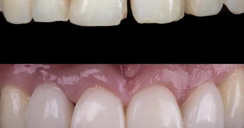 H&N Dent Dentista en Azcapotzalco, consultorio dental en Azcapotzalco, Ciudad de México