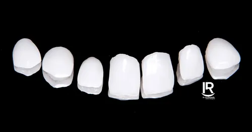 Clínica Dental | Prime Dental Studio, consultorio dental en Benito Juárez, Ciudad de México