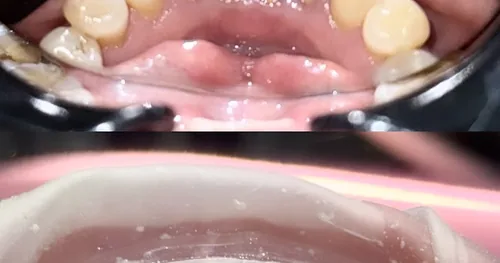 Consultorio Dental Coyoacán, consultorio dental en Coyoacán, Ciudad de México