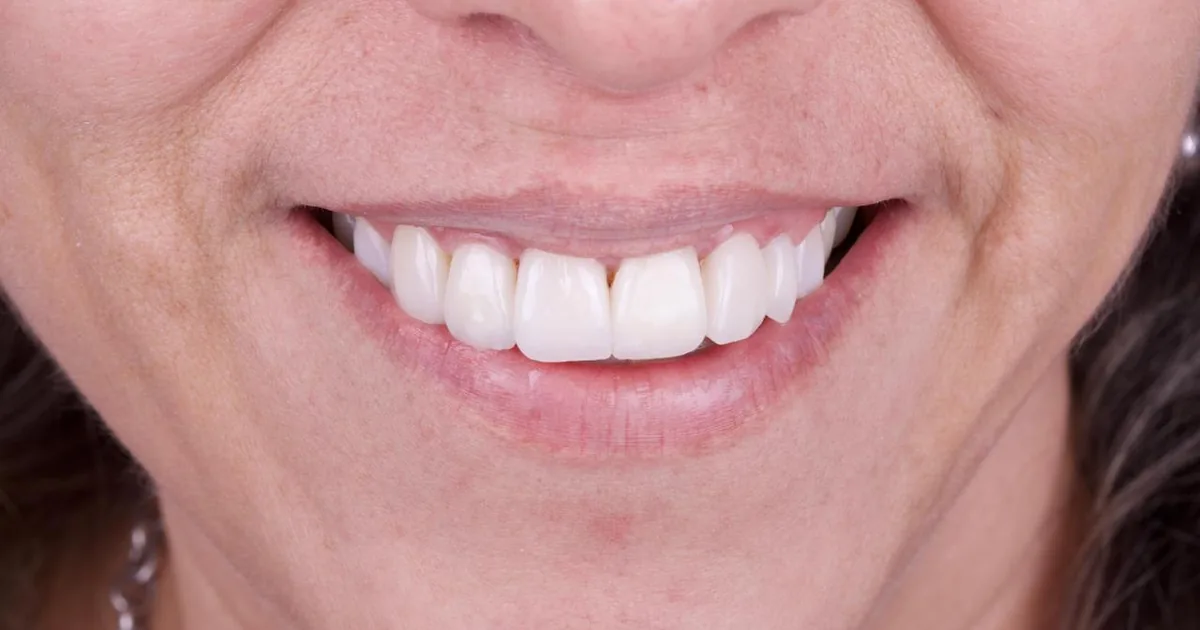 Clínica Dental «Integra Dental Coyoacán»
