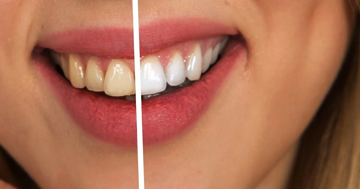 Clínica Dental Santo Domingo