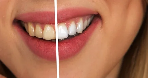 Clínica Dental Santo Domingo, consultorio dental en Coyoacán, Ciudad de México