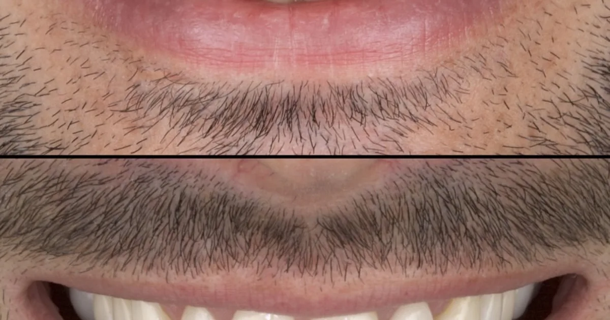 Dentista en Cdmx. Dr Yamil Romero