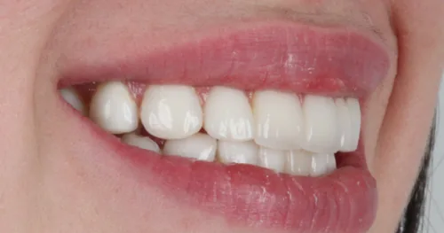Dra.Laura Rojas-Odontología Integral, consultorio dental en Cuauhtémoc, Ciudad de México