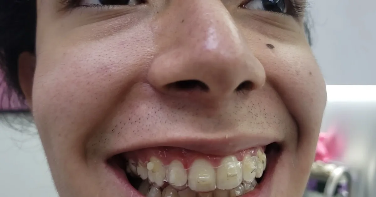 ZUN CLINIK. Clínica de Especialidades Dentales