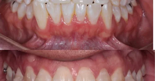 Dra. Liliana Soto, Dentista – Odontólogo, consultorio dental en Iztapalapa, Ciudad de México