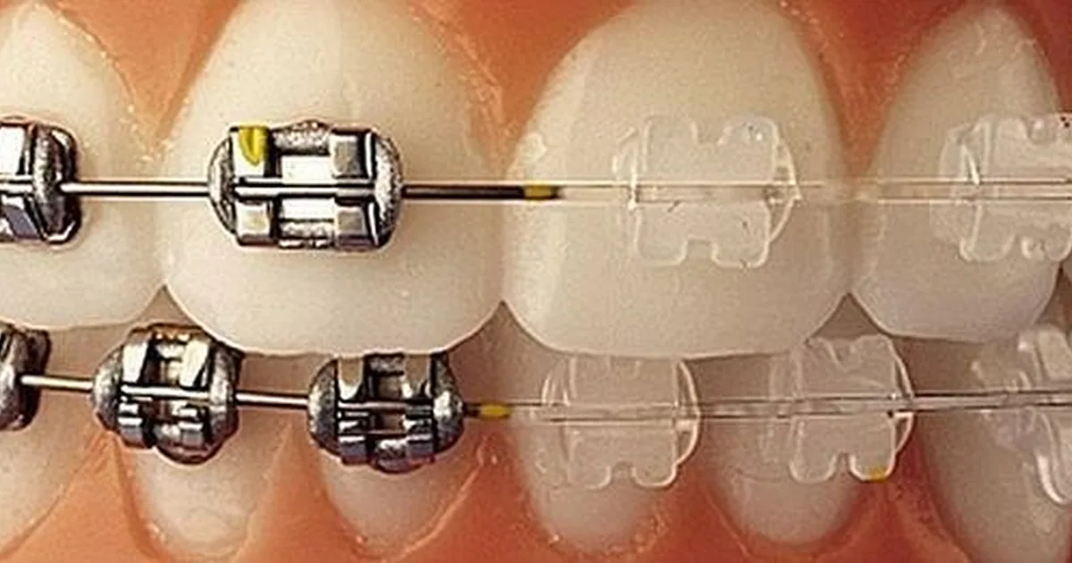 Dentista Polanco G&B Smile