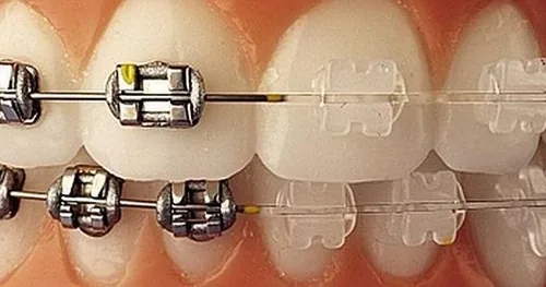 Dentista Polanco G&B Smile, consultorio dental en Miguel Hidalgo, Ciudad de México