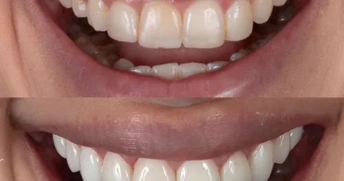 GLOSS DENT® – Dentista en Polanco, consultorio dental en Miguel Hidalgo, Ciudad de México