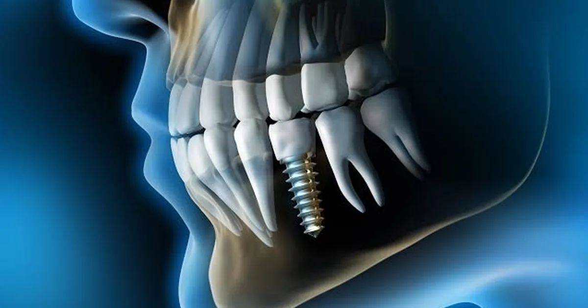 Clínica Dental – Hey Tooth