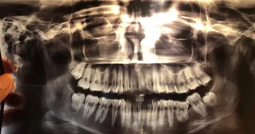 Clínica Odontologica de Especialidades, consultorio dental en Tláhuac, Ciudad de México