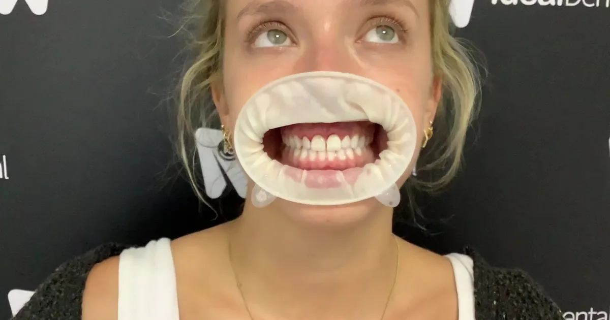 Ideal Dental (Dental Tourism)