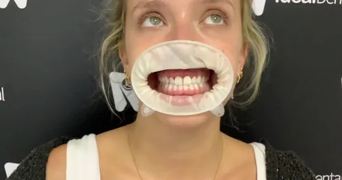 Ideal Dental (Dental Tourism), consultorio dental en Venustiano Carranza, Ciudad de México