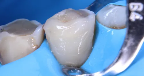 Dental Gaia CDMX (Dental Tourism), consultorio dental en Venustiano Carranza, Ciudad de México