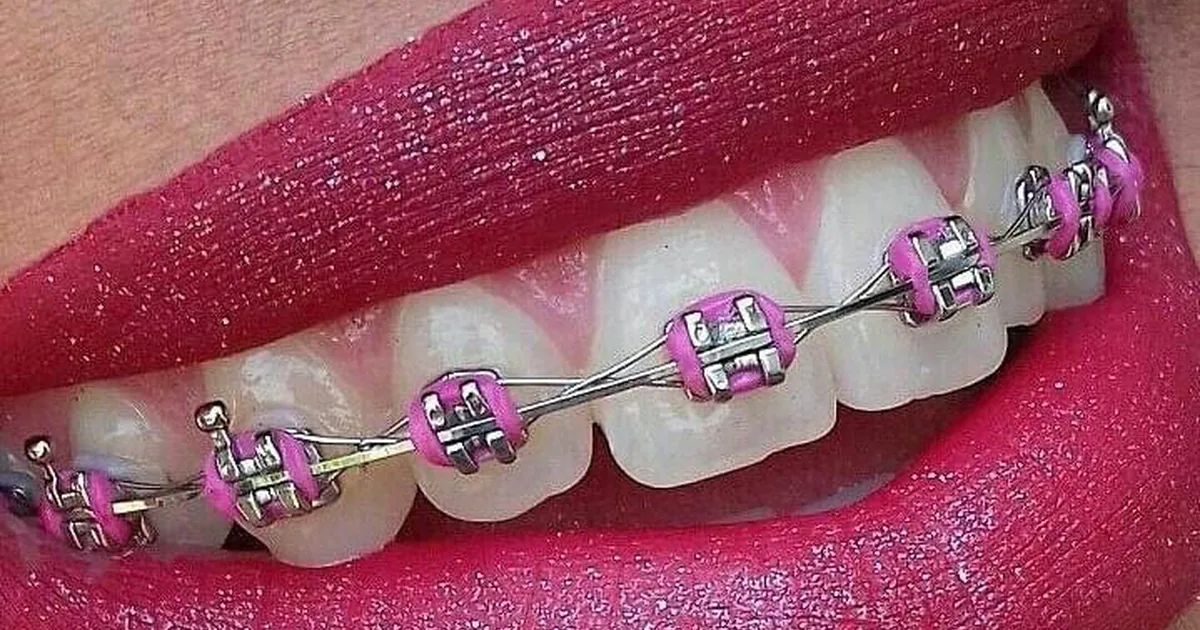 Apple Dental
