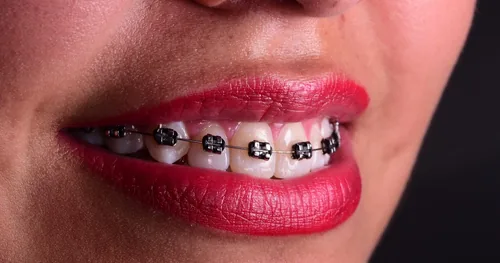 Servicios Odontológicos Del Sur «Odontología Especializada»», consultorio dental en Xochimilco, Ciudad de México